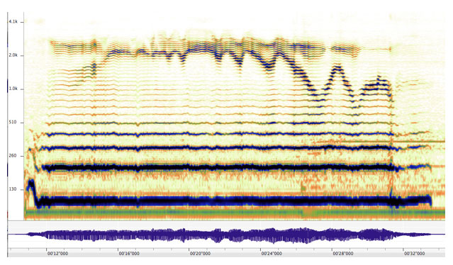 Sonogram of Timothy Hill